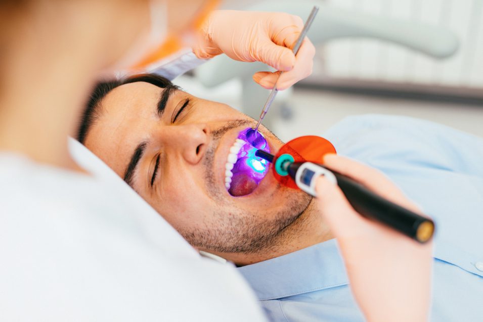 Dental curing light
