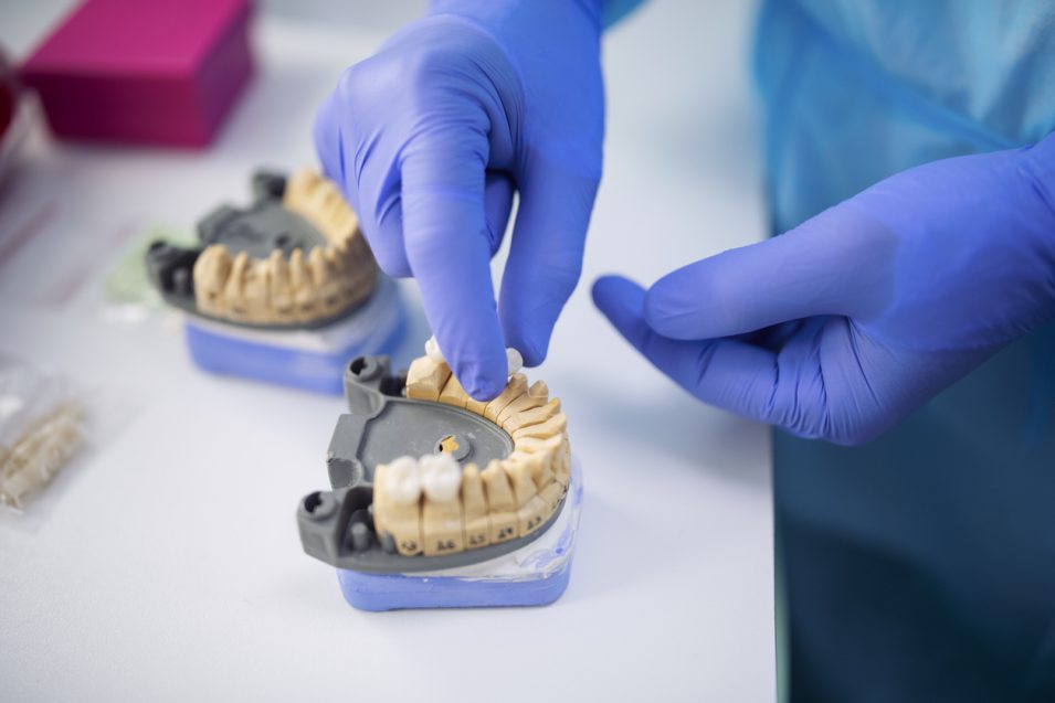 how dental crowns are made
