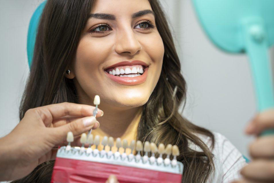 what to expect when veneers are placed