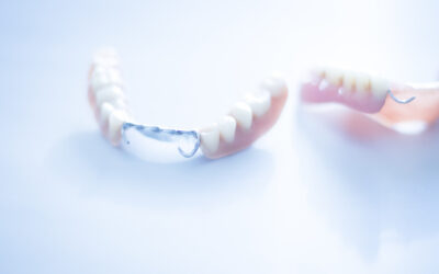 What’s The Value of Partial Dentures?