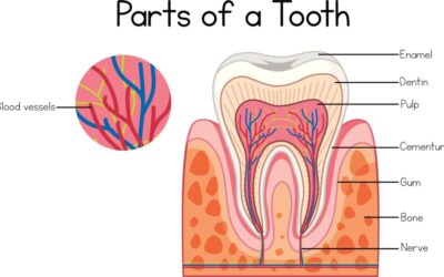 Signs That You Need Root Canal Therapy