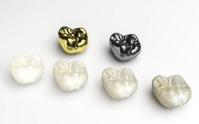 When is a Dental Crown Needed?