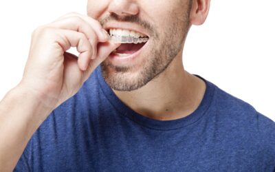 Is it Worth It to Get Invisalign?