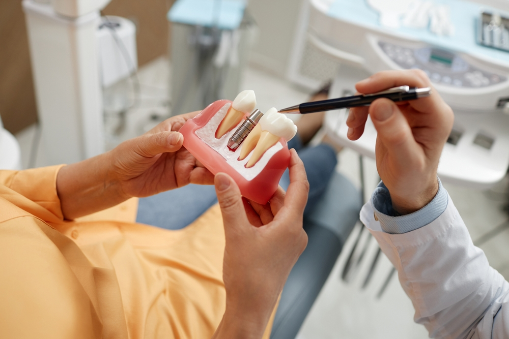 What Do Dental Implants Look Like?