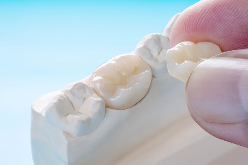 A dental prosthetic crown is used to restore a damaged or weakened tooth in restorative dentistry treatment.