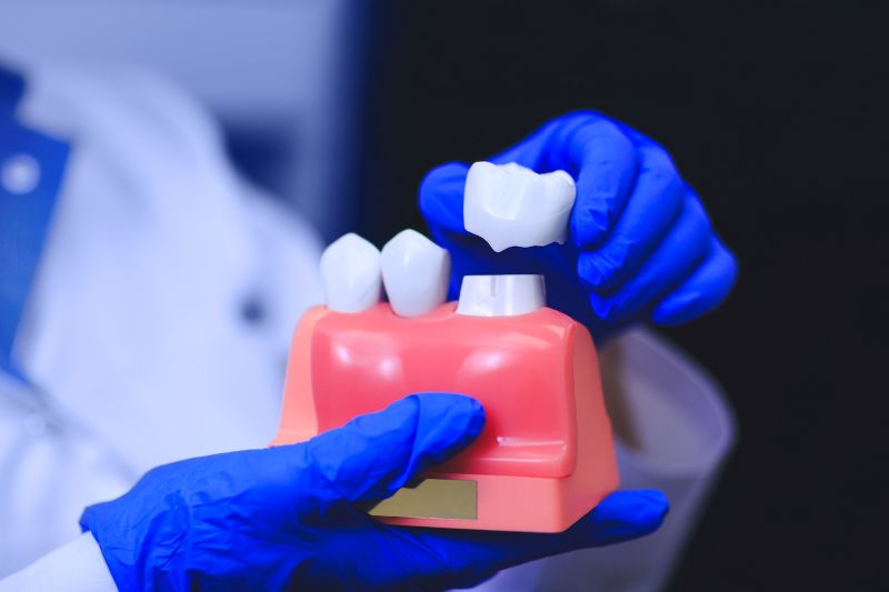 Same-Day Dental Crowns: Advantages, Disadvantages & Pricing Guide