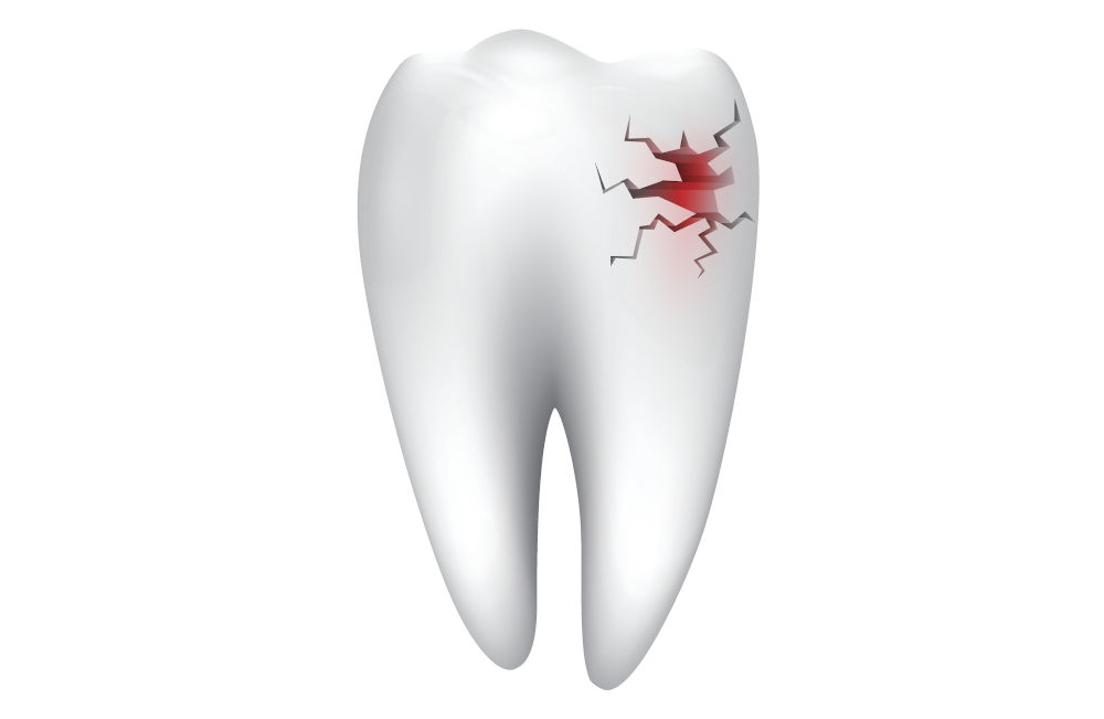 Tooth pain when chewing from cracked tooth Person experiencing tooth pain when chewing due to cracked tooth